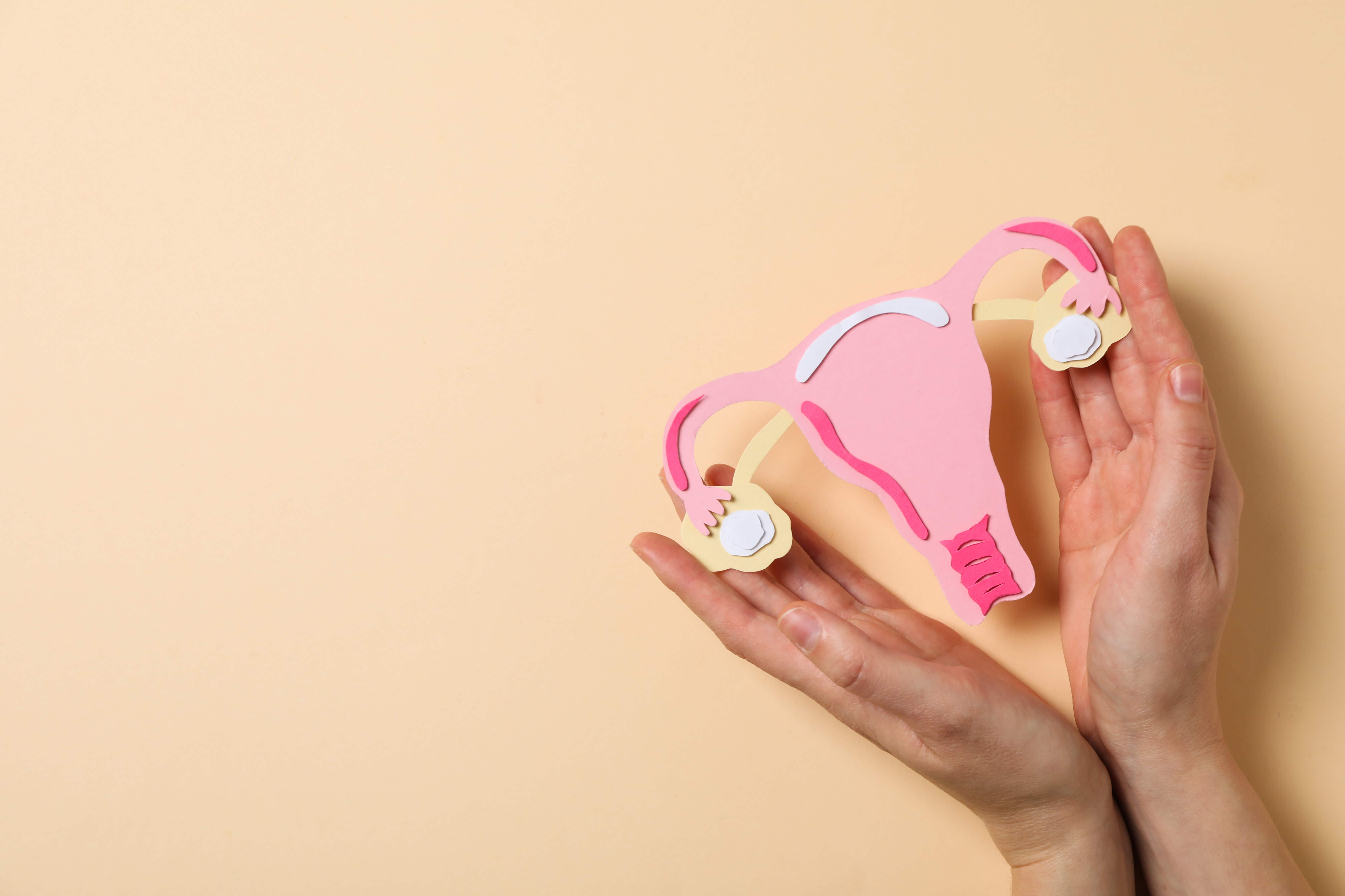 Endometriosis, de la sospecha a la certeza Endometriosis, de la sospecha a la certeza