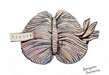 Desvelan cómo el nacimiento prematuro altera el desarrollo cerebral Desvelan cómo el nacimiento prematuro altera el desarrollo cerebral